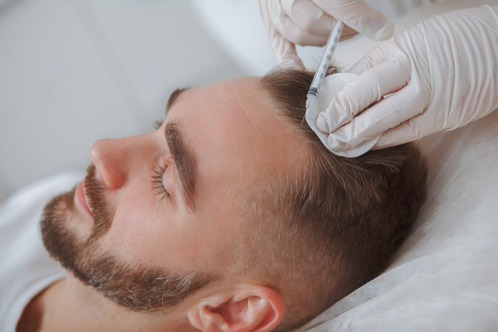 Aesthetician,Giving,Hairloss,Treatment,Injections,Into,Scalp,Of,Male,Client