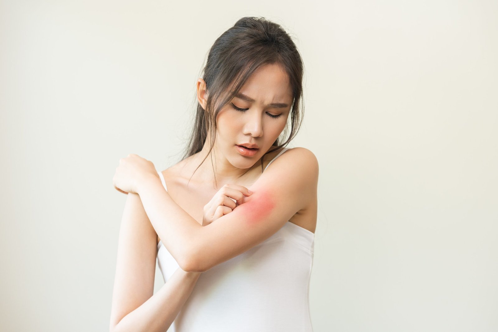 Dermatology,Asian,Young,Woman,,Girl,Allergy,,Allergic,Reaction,From,Atopic,