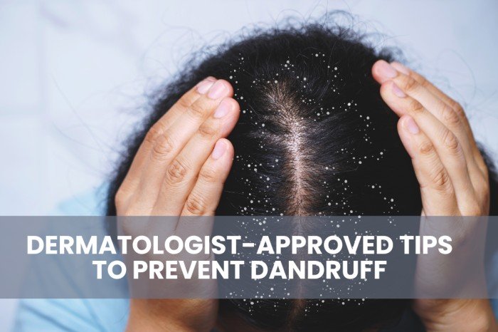 Dermatologist-Approved Tips To Prevent Dandruff