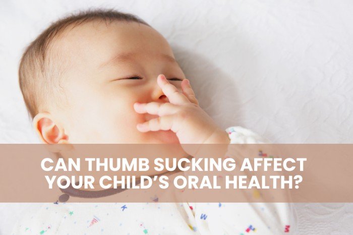Can Thumb Sucking Affect Your Child’s Oral Health?