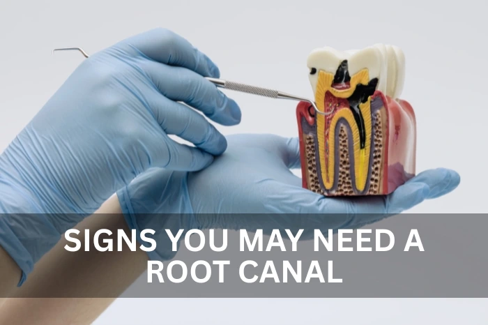 Signs You May Need a Root Canal