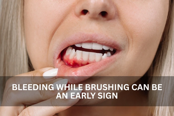 gum disease treatment in dubai